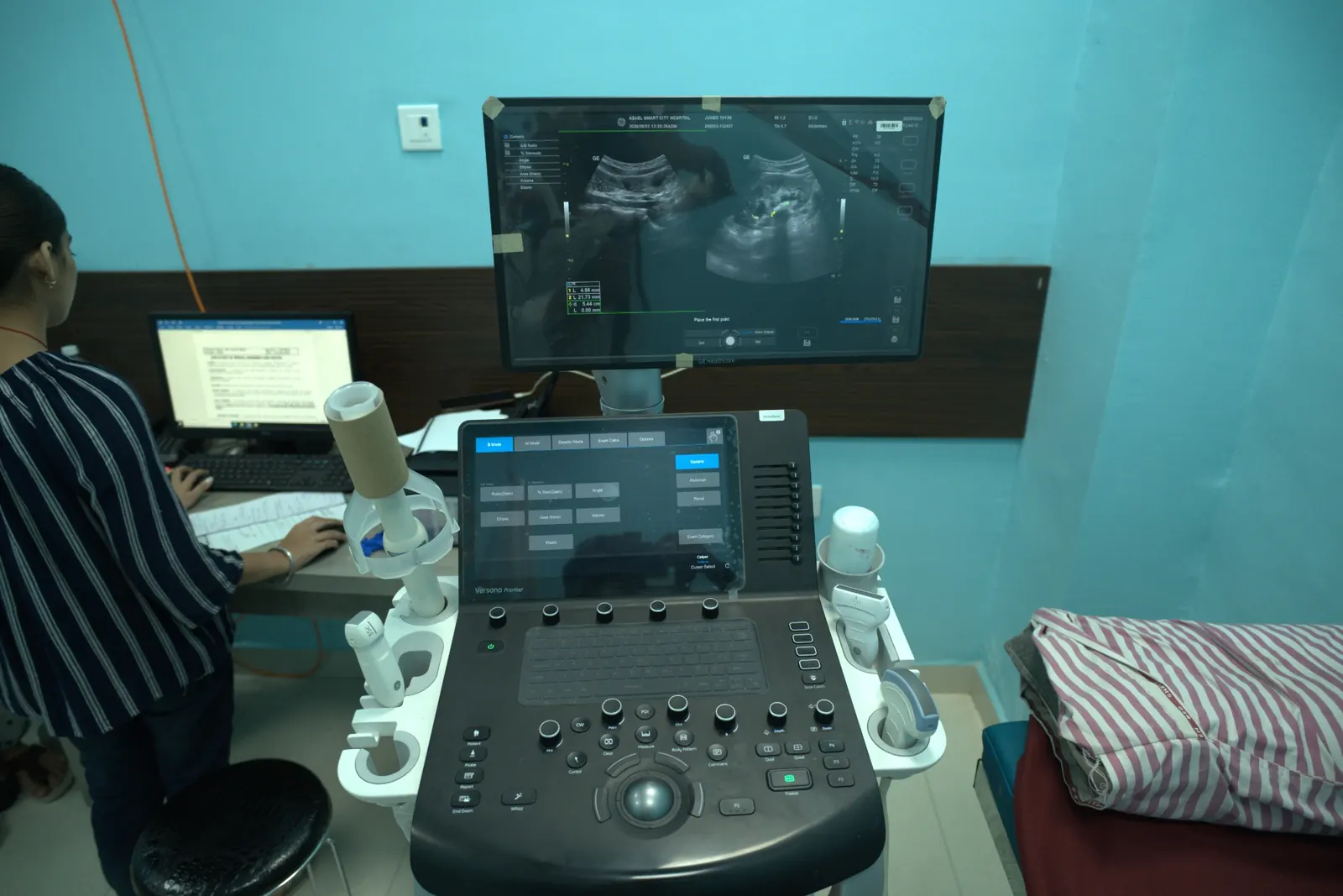 Ultrasound equipment at Smart City Hospital